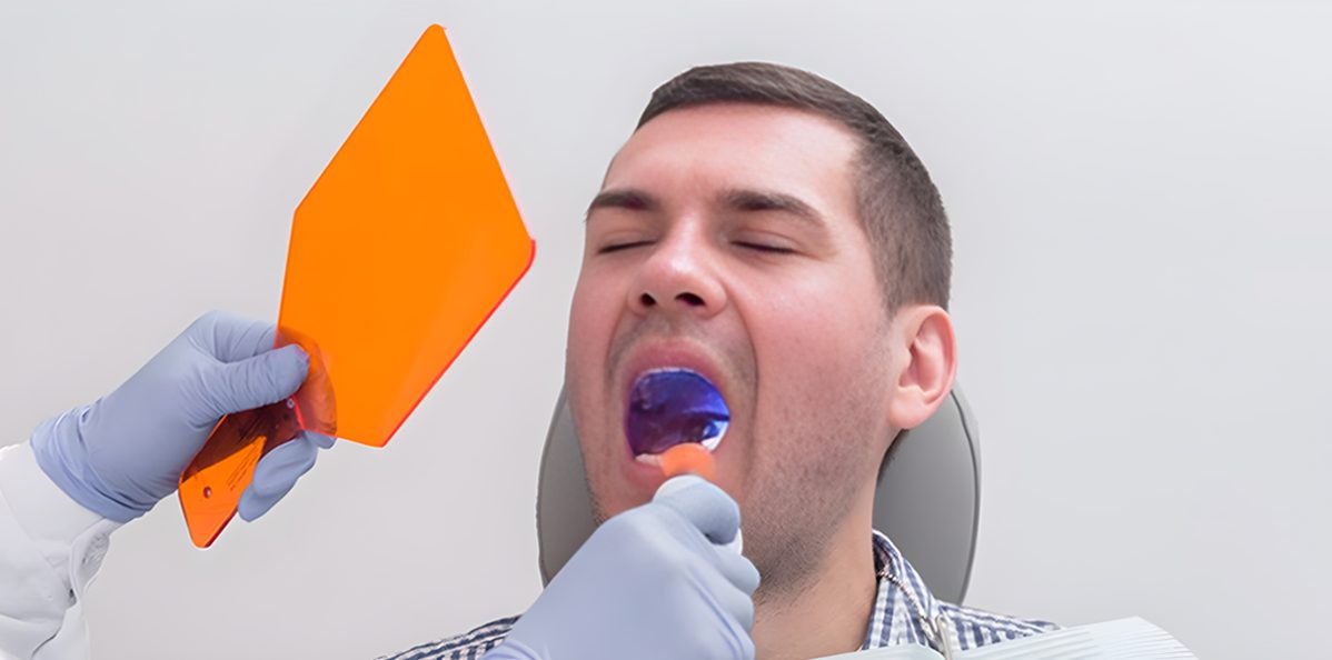 Dentist in Murray, UT, Tooth Extractions in Murray, UT, dentist near you,